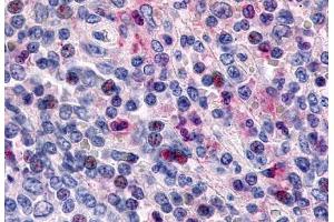 Anti-CCR1 antibody  ABIN1048385 IHC staining of human spleen, lymphocytes. (CCR1 anticorps  (Extracellular Domain))