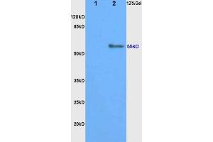 L1 rat kidney, L2 rat brain lysates probed (ABIN750823) at 1:200 in 4 °C.