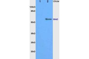 L1 rat kidney, L2 rat brain lysates probed (ABIN750823) at 1:200 in 4 °C. (CYP11B1 anticorps  (AA 301-400))