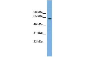 WB Suggested Anti-CYP26B1 Antibody Titration: 0.