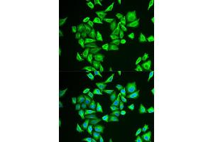 Immunofluorescence analysis of U2OS cells using PGM1 antibody (ABIN5973725). (Phosphoglucomutase 1 anticorps)
