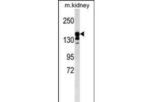 ABCC9 Antibody (Center) (ABIN1538549 and ABIN2849844) western blot analysis in mouse kidney tissue lysates (35 μg/lane). (ABCC9 anticorps  (AA 640-669))