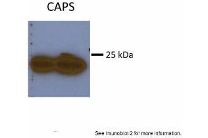 Sample Type: Huh7 HepG2 (50ug)Primary Antibody Dilution:1:500Image Submitted By: Partha KasturiUniversity of Kansas Medical Center (Calcyphosine anticorps  (N-Term))