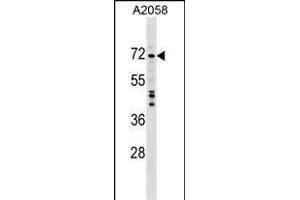 DDX56 Antibody (C-term) (ABIN1537431 and ABIN2848934) western blot analysis in  cell line lysates (35 μg/lane). (DDX56 anticorps  (C-Term))