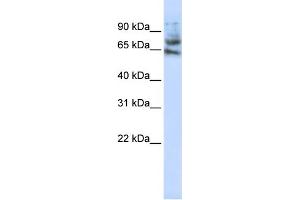 WB Suggested Anti-MCTP1 Antibody Titration:  1 ug/ml  Positive Control:  Jurkat cell lysate (MCTP1 anticorps  (Middle Region))