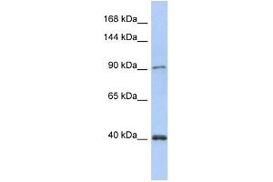 WB Suggested Anti-POLK Antibody Titration:  0. (POLK anticorps  (N-Term))
