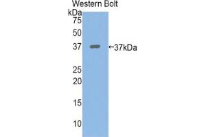 Western blot analysis of the recombinant protein. (PPL anticorps  (AA 1439-1716))