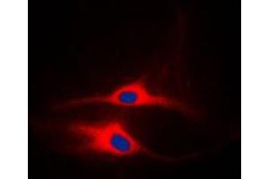 Immunofluorescent analysis of LCK staining in MCF7 cells. (LCK anticorps  (Center))