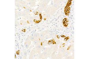 Immunohistochemistry of paraffin-embedded Human liver (negative control sample) using Cytokeratin 19 (KRT19) Rabbit pAb (ABIN3020778, ABIN3020779, ABIN3020780 and ABIN6213719) at dilution of 1:50 (40x lens).