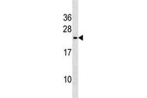 Trem2 antibody western blot analysis in mouse heart tissue lysate.