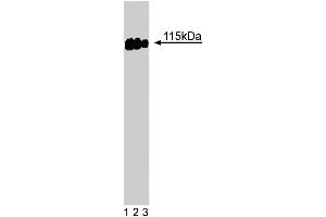 Western blot analysis of SRPK2 on a A431 cell lysate (Human epithelial carcinoma, ATCC CRL-1555). (SRPK2 anticorps  (AA 363-485))