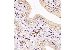 Immunohistochemistry of paraffin embedded rat bladder using MYL6 (ABIN7074734) at dilution of 1:650 (400x lens)