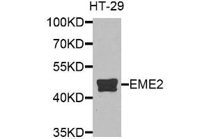 Western blot analysis of extracts of HT-29 cells, using EME2 antibody (ABIN6003623) at 1/1000 dilution. (EME2 anticorps)