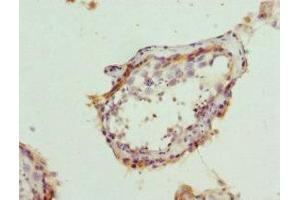 anti-B-Cell Receptor-Associated Protein 29 (BCAP29) (AA 125-241) antibody