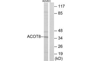 Western blot analysis of extracts from HUVEC cells, using ACOT8 antibody. (ACOT8 anticorps  (Internal Region))