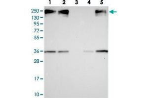 Western blot analysis of Lane 1: RT-4, Lane 2: U-251 MG, Lane 3: Human Plasma, Lane 4: Liver, Lane 5: Tonsil with ZC3H4 polyclonal antibody  at 1:250-1:500 dilution. (ZC3H4 anticorps)