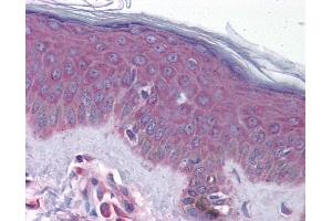 Immunohistochemistry (IHC) image for anti-Gap Junction Protein, beta 1, 32kDa (GJB1) (Middle Region) antibody (ABIN2774854) (GJB1 anticorps  (Middle Region))