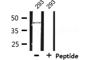 Western blot analysis of extracts from 293, using SYT Antibody.