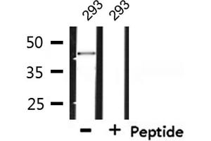 Western blot analysis of extracts from 293, using SYT Antibody. (SS18 anticorps  (N-Term))