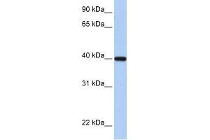 RDH11 antibody used at 1 ug/ml to detect target protein. (RDH11 anticorps)