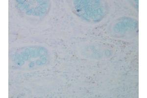Immunohistochemistry analysis using Mouse Anti-Nitrotyrosine Monoclonal Antibody, Clone 39B6 (ABIN361657 and ABIN361658).