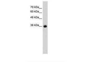 Image no. 1 for anti-gamma-aminobutyric Acid (GABA) A Receptor, gamma 2 (GABRG2) (AA 334-383) antibody (ABIN203317)