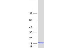Validation with Western Blot