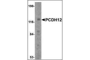 Western blot analysis of PCDH12 in K562 cell lysate with this product at 2 μg/ml. (PCDH12 anticorps  (N-Term))