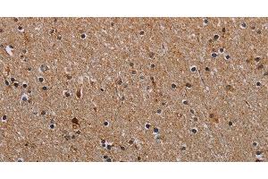 Immunohistochemistry of paraffin-embedded Human brain using NDUFA8 Polyclonal Antibody at dilution of 1:40