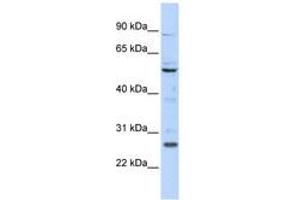 Image no. 1 for anti-Homeobox C5 (HOXC5) (N-Term) antibody (ABIN6740598) (Homeobox C5 anticorps  (N-Term))