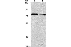 Western blot analysis of A549 and 231 cell, using NEK11 Polyclonal Antibody at dilution of 1:1000 (NEK11 anticorps)