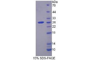 SDS-PAGE (SDS) image for Methylcrotonoyl-CoA Carboxylase 2 (Beta) (MCCC2) (AA 380-563) protein (His tag) (ABIN6239410) (MCCC2 Protein (AA 380-563) (His tag))