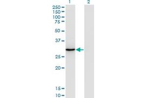 Western Blot analysis of ORC6L expression in transfected 293T cell line by ORC6L monoclonal antibody (M04), clone 3C4.