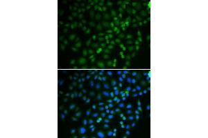 Immunofluorescence (IF) image for anti-Tripartite Motif Containing 21 (TRIM21) (AA 80-330) antibody (ABIN3015762) (TRIM21 anticorps  (AA 80-330))