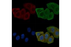 ABIN6261447 and ABIN6268757 staining Hela cells(30 min of UV treatment) by IF/ICC.