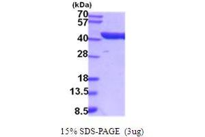 SDS-PAGE (SDS) image for Aldolase C, Fructose-Bisphosphate (ALDOC) (AA 1-363) protein (His tag) (ABIN5854218)