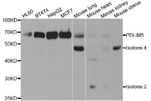 Western blot analysis of extracts of various cell lines, using PDLIM5 antibody.