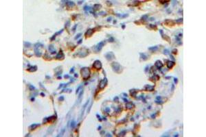 Used in DAB staining on fromalin fixed paraffin-embedded lung tissue (CEACAM6 anticorps  (AA 35-142))