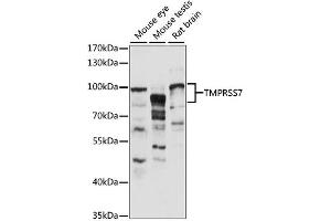 Western blot analysis of extracts of various cell lines, using TMPRSS7 antibody (ABIN6294019) at 1:1000 dilution.