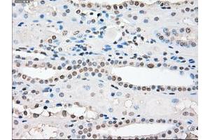 Image no. 9 for anti-Protein Phosphatase 5, Catalytic Subunit (PPP5C) antibody (ABIN1500391)