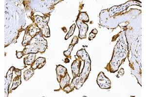IHC analysis of ADAMTS5 using anti-ADAMTS5 antibody (ABIN7602411).