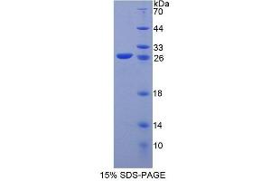SDS-PAGE analysis of Human KEL Protein. (KEL Protéine)