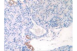 IHC-P analysis of Mouse Kidney Tissue, with DAB staining. (APOC1 anticorps  (AA 32-88))