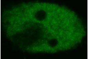 Confocal microscopy of human HeLa cells using anti-p53 (BP53-12 ; FITC).