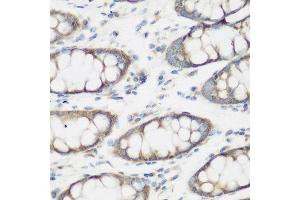 Immunohistochemistry of paraffin-embedded human colon using SHBG antibody at dilution of 1:200 (40x lens).