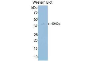 Western blot analysis of the recombinant protein. (EPAS1 anticorps  (AA 24-348))