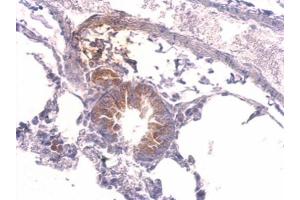 IHC-P Image Tyrosyl tRNA synthetase antibody detects YARS protein at cytosol on mouse lung by immunohistochemical analysis. (YARS anticorps  (C-Term))