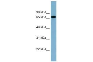 SNAG1 antibody used at 1 ug/ml to detect target protein. (SNX18 anticorps  (N-Term))