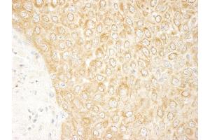 Immunohistochemistry (IHC) image for anti-Mitogen-Activated Protein Kinase Kinase Kinase MLT (ZAK) (AA 750-800) antibody (ABIN7448872) (ZAK anticorps  (AA 750-800))