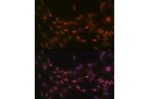 Immunofluorescence analysis of C6 cells using PRMT1 Rabbit mAb  at dilution of 1:100 (40x lens).